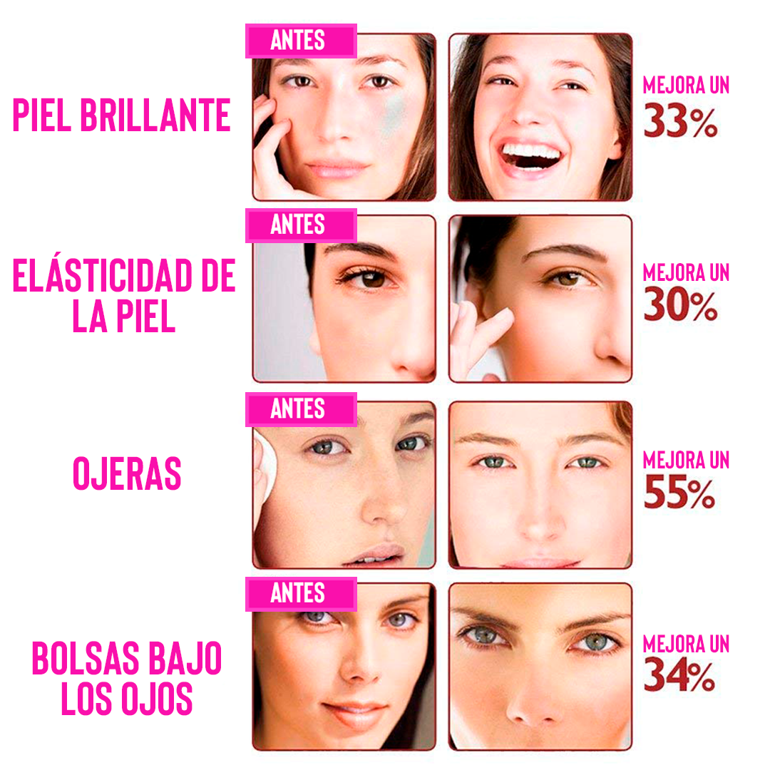 Eliminador de Arrugas Facial Iónico 💧 | Masaje + Rejuvenecimiento